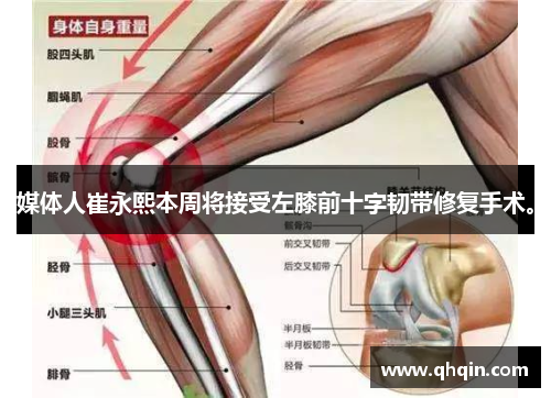 媒体人崔永熙本周将接受左膝前十字韧带修复手术。 媒体人崔永熙本周将接受左膝前十字韧带修复手术。